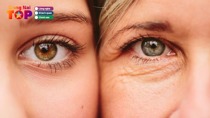 Top-5-dia-chi-xoa-nep-nhan-tai-dong-nai-an-toan-cong-nghe-cao-dongnaitoplist