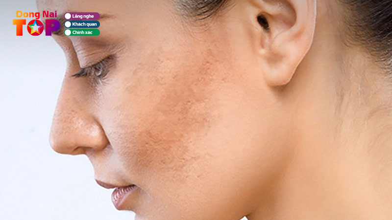 Top-10-dia-chi-tri-nam-tai-dong-nai-hieu-qua-tan-goc-dongnaitoplist