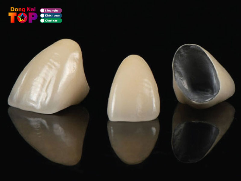 Cac-loai-rang-su-pho-bien-lua-chon-da-dang-cho-moi-nhu-cau1-dongnaitoplist