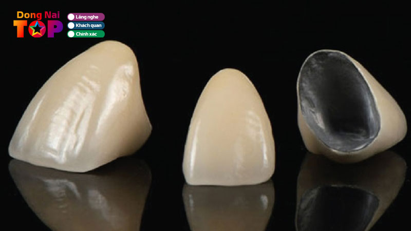 Giai-phap-trong-rang-su-da-dang-tai-nha-khoa-uy-tin-an-toan-tham-my-dongnaitoplist